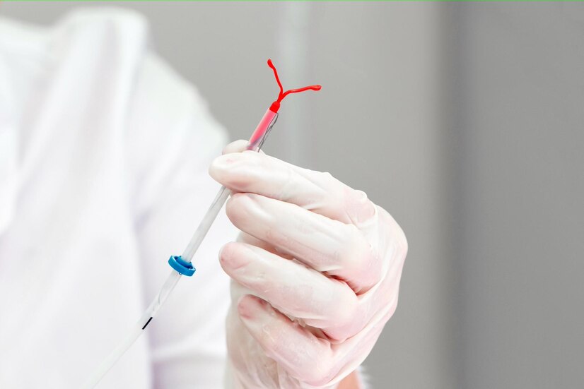 exsudado endocervical simples
